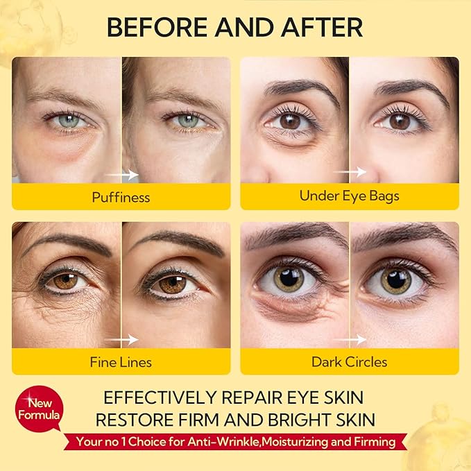 LANBENA Under Eye Patches (30 Pairs) - Gold Under Eye Mask Retinol & Collagen, Under Eye Mask for Face Care, Eye Masks for Dark Circles and Puffiness, Under Eye Masks for Beauty & Personal Care
