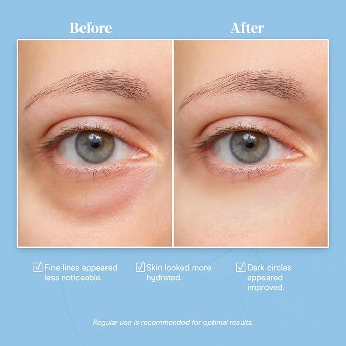 Baebody Snail Mucin Eye Cream (30 ml/1.06 fl oz) - Anti-Aging Korean Eye Cream for Dark Circles and Dry Skin - Snail Mucin Serum with Peptides and Hyaluronic Acid