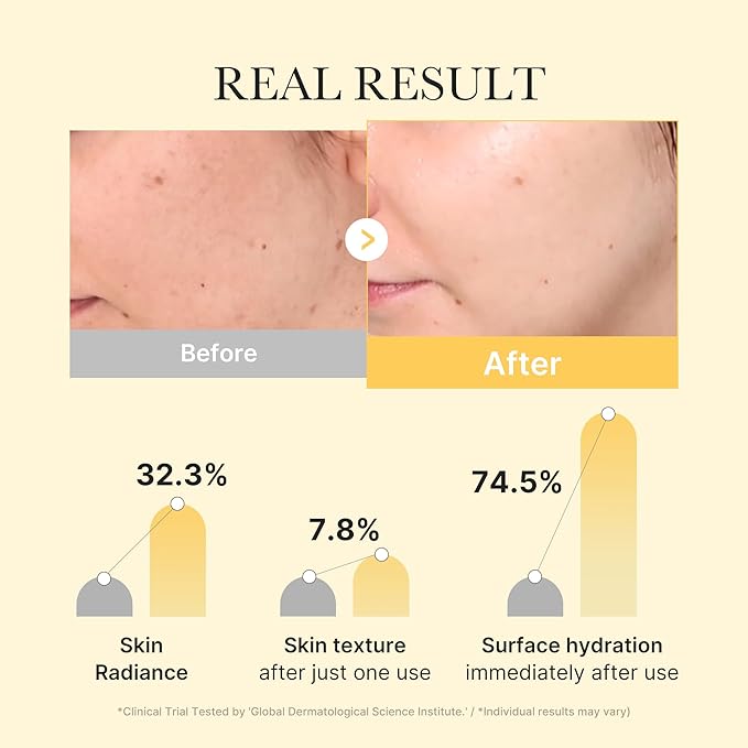 medicube Jelly Gel Mask with Brightening Kojic Acid Turmeric | Overnight Face Mask for Glass Glow Skin | Elasticity, Hydrating, Firming and Radiance Boosting | Korean Skincare, 28g x 4ea