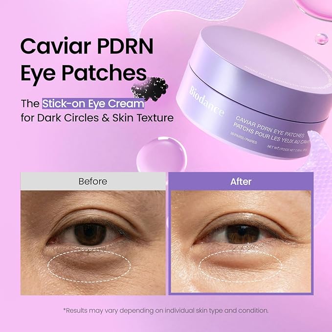 BIODANCE Caviar PDRN Eye Patches, Nourishing Under Eye Patches for Dark Circles, Depuffing Eye Mask for Puffy & Tired Eyes, Travel Essentials & Self Care Gifts for Women, Korean Skin Care (60 Count)