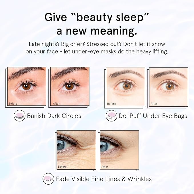 grace & stella Retinol Under Eye Patches for Puffy Eyes and Dark Circles - Restoring Gel Under Eye Masks with Hyaluronic Acid - Vegan Skincare, Self Care Gifts for Women (Purple, 48 Pairs)