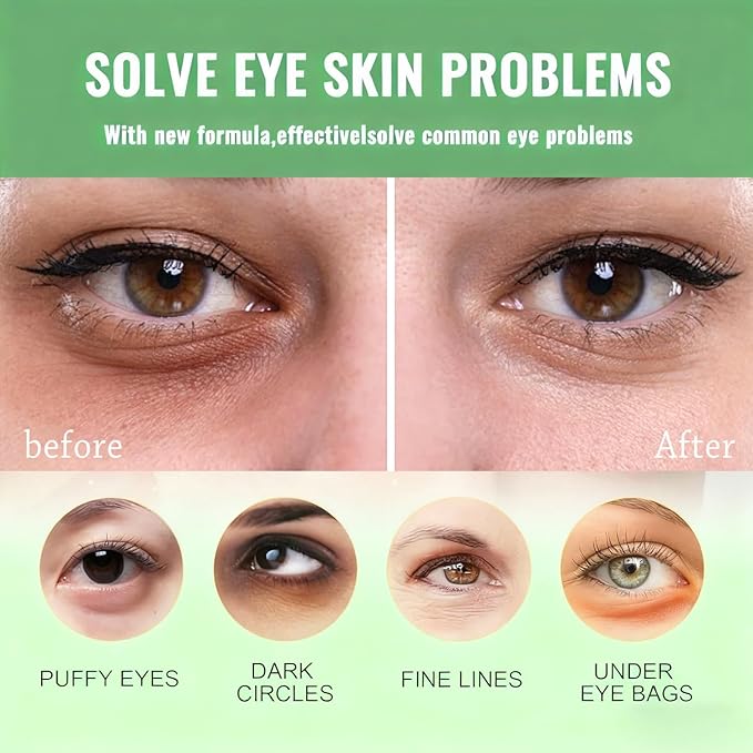 firstfly 60 Pcs Avocado Eye Mask, Under Eye Patches for Dark Circles and Puffiness, Moisturizing Nourishing Eye Treatment Mask, Improving Eye Skin Dryness, Fine Lines and Wrinkles