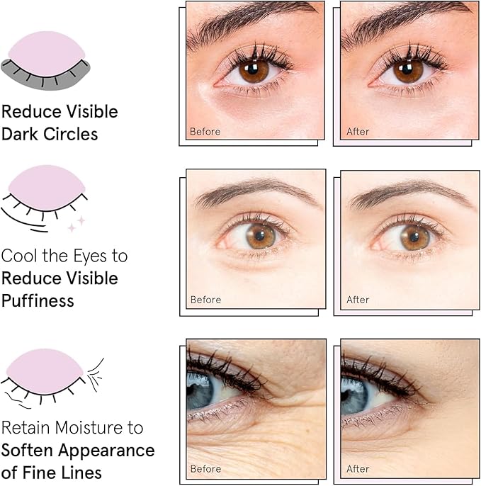 grace & stella Award Winning Under Eye Mask - Teen Gifts, Gel Eye Patches for Dark Circles, Puffy Eyes, Wrinkles, Undereye Bags, Travel Gifts for Women - Vegan, Self Care (6 Pairs, Gold)