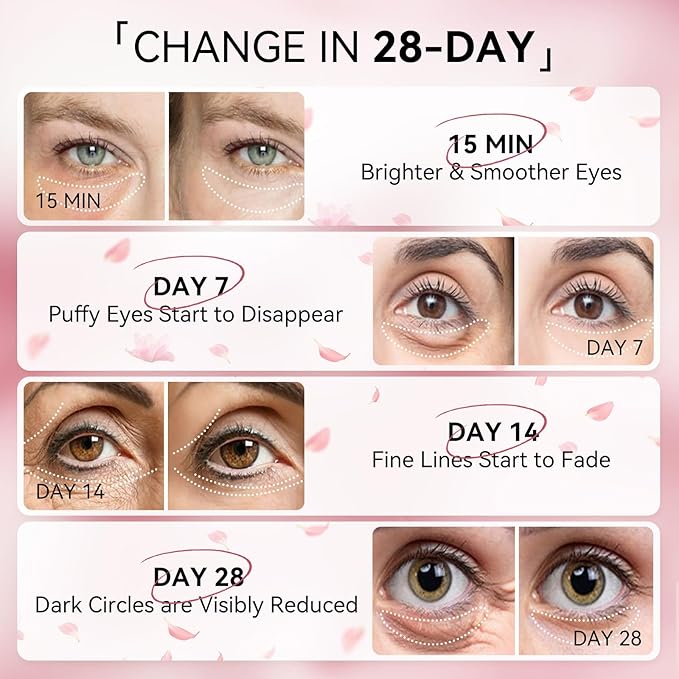 BREYLEE Flamingo Pink Eye Mask–60 Pcs-Puffy Eyes and Dark Circles Treatments–Look Younger and Reduce Wrinkles and Fine Lines Undereye, Improve and Firm eye Skin-Pure Natural Material Extraction