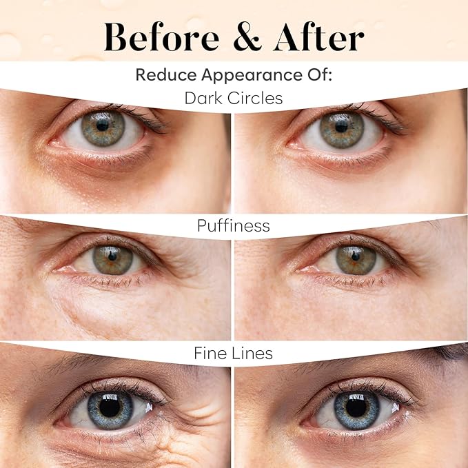Caffeine Under Eye Patches (30 Pairs), Under Eye Mask for Puffy Eyes, Appearance of Dark Circles, Cooling & Hydration, Self Care & Skincare Gifts for Women, Patch Yeux