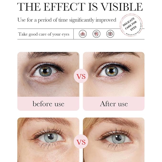 Eakroo Rose Eye Masks - 60 PCS Under Eye Patches for Puffy Eyes and Dark Circles Treatments - Hydrating Eye Mask Skincare, Eye Gel Pads for Eye, Reduce Wrinkles and Fine Lines, Improve Eye Skin