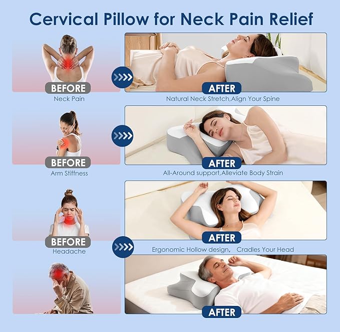 Cervical Neck Pillow for Neck Pain Relief, Ergonomic Memory Foam Contour Pillow for Sleeping, Cooling Butterfly Pillow for Back,Side,Stomach Sleepers, Orthopedic Bed Pillow for Neck Support(White)
