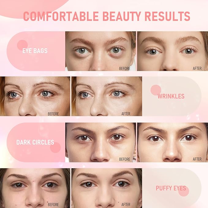 LAVONE Eye Mask - 30 Pairs Rose Under Eye Patches Skin Care Products,Eye Masks Skincare for Dark Circles and Puffiness, Reduce Wrinkles, Eye Bags and Fine Lines, for Women and Man - Pink