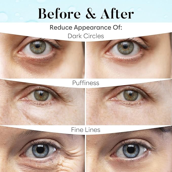 Retinol & Collagen Under Eye Patches (30 Pairs), Under Eye Mask for Puffy Eyes, Appearance of Dark Circles, Smoothing & Hydration, Self Care & Skincare Gifts for Women, Patch Yeux