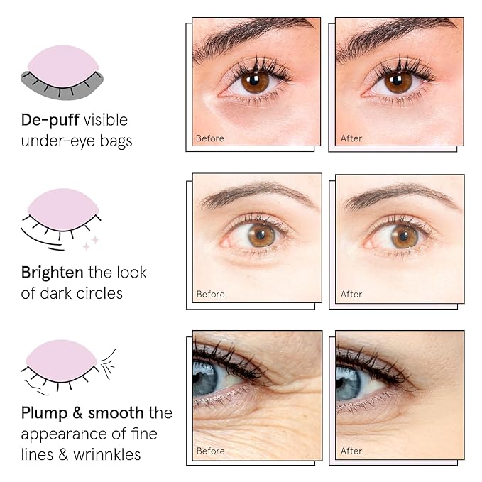 grace & stella Under Eye Patches (12 pairs) Eye Masks for Dark Circles and Puffiness - Gifts for Her, Travel & Self Care Gifts, Bachelorette Party Favors - Vegan Cruelty-Free Skin Care