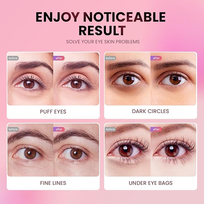 Under Eye Patches (48 Pairs) - Tri-color Glitter Eye Gel Pads for Dark Circles, Puffy Eyes, Under eye Bags, Wrinkles | Natural Collagen Under Eye Mask Patches, Gel Under Eye Patches