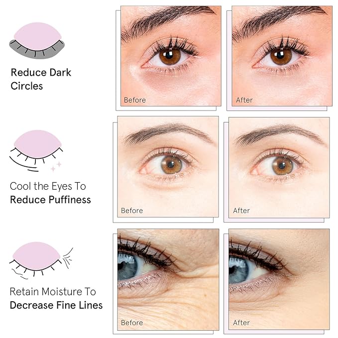 grace & stella Under Eye Mask Variety Pack - 18 Pairs of Under Eye Patches for Dark Circles - With 6 Colors (3 Pairs/Color) - Gifts for Women - Gel Masks Puffy Eyes for Women, Vegan