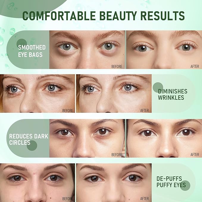 LAVONE Eye Mask - 30 Pairs Seaweed Under Eye Patches Skin Care Products - Eye Masks Skincare for Dark Circles and Puffiness, Reduce Wrinkles, Eye Bags and Fine Lines, for Women and Man - Dark Green