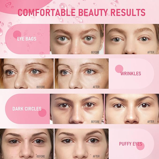 LAVONE Eye Mask - 15 Pairs Rose Under Eye Patches Skin Care Products - Eye Masks Skincare for Dark Circles and Puffiness, Reduce Wrinkles, Eye Bags and Fine Lines, for Women and Man - Pink