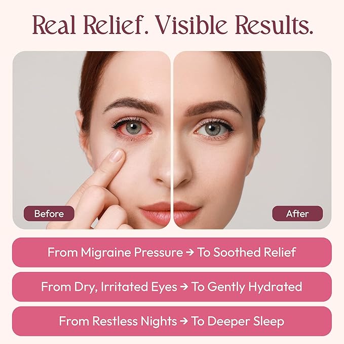 Fomin Self Heating Eye Mask - 20 Packs - Rose & Jasmine Heated Eye Mask Warm Compress for Eyes, Disposable Self Heating Steam Mask for Home, Sleep, Spa, Travel Essentials & Relaxation Gifts for Women