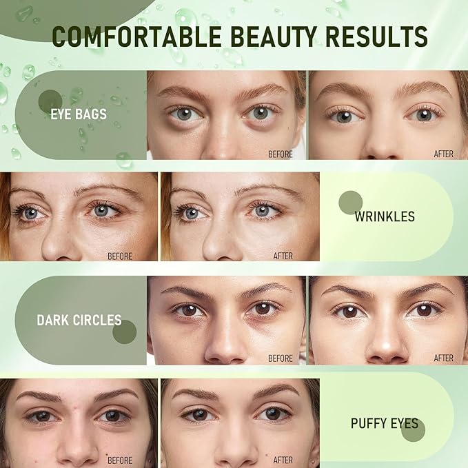 LAVONE Eye Mask - 30 Pairs Avocado Under Eye Patches Skin Care Products - Eye Masks Skincare for Dark Circles and Puffiness, Reduce Wrinkles, Eye Bags and Fine Lines, for Women and Man - Soft Green
