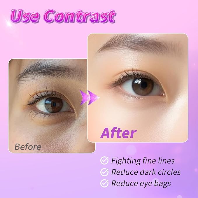 Eye Masks (24 Pairs) - Gift for Her - Tri-color Under Eye Patches for Dark Circles, Puffiness, Wrinkles, Soothing & Hydrating, Skincare Eye Gel Pads, Beauty Essential for Women, Easter Basket Stuffers