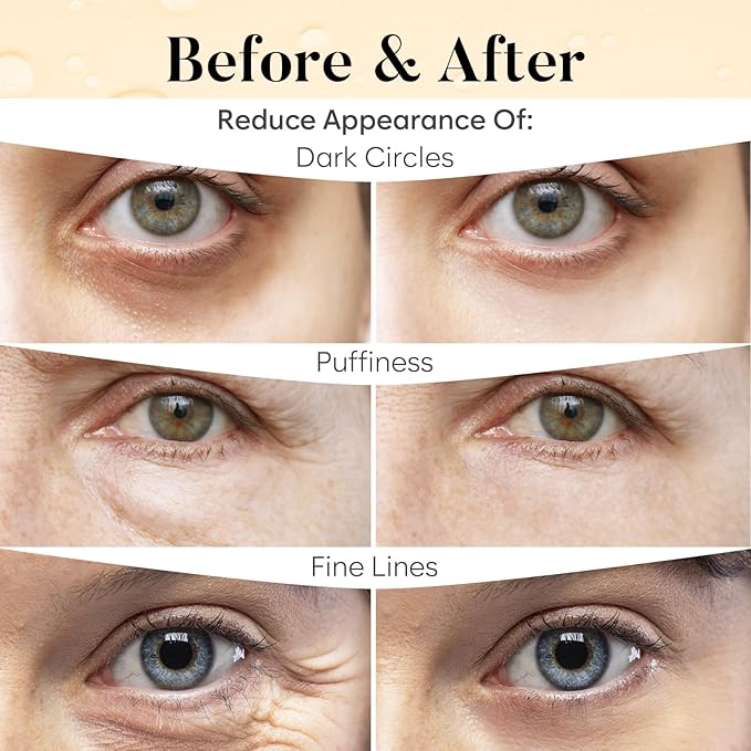 Vitamin C & Caffeine Under Eye Patches (30 Pairs), Under Eye Mask for Puffy Eyes, Appearance of Dark Circles, Smoothing & Hydration, Self Care & Skincare Gifts for Women, Patch Yeux
