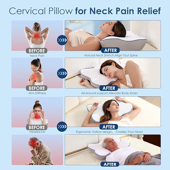 Cervical Neck Pillow for Pain Relief, Ergonomic Side Sleeper Pillow for Neck Support, Cooling Memory Foam Pillows Contour Orthopedic Bed Pillow for Back Stomach Sleepers (White)