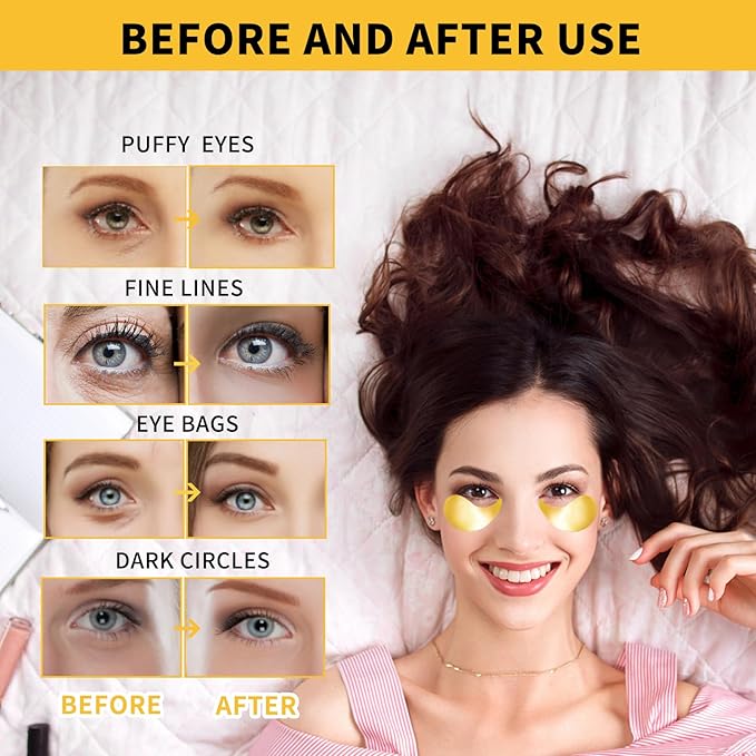 24K Gold Eye Masks for Dark Circles and Puffiness 70PCS, Under Eye Patches for Puffy Eyes Treatment, Under Eye Gel Pads w/ Collagen, Caffeine, Peptides for Eye Bags Treatment, Gel Eye Mask Skincare