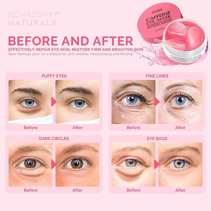 Under Eye Patches for Puffiness Kit: 120 Pcs Green Tea & Caffeine Eye Mask for Dark Circles and Anti-Aging - Day & Night Skin Eye Pads with Niacinamide, Collagen, Hyaluronic Acid & Vitamin C (2 Pack)