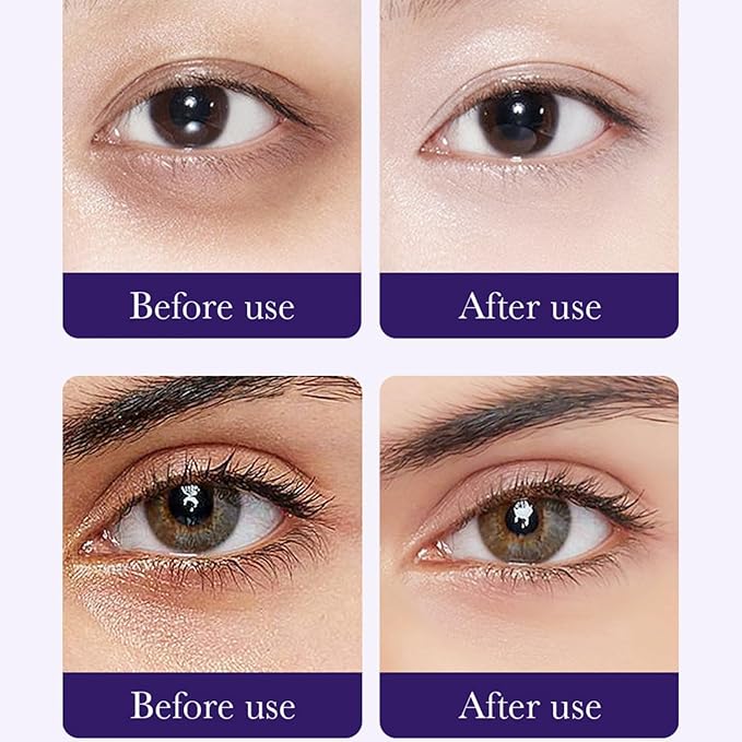 Eakroo Grape Eye Masks - 60 PCS Under Eye Patches for Puffy Eyes and Dark Circles Treatments - Hydrating Eye Mask Skincare, Eye Gel Pads for Eye, Reduce Wrinkles and Fine Lines, Improve Eye Skin