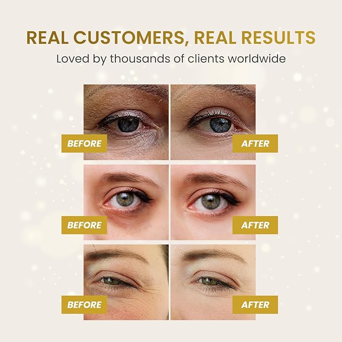 PLANTIFIQUE 24K Gold Under Eye Patches 20 Pairs - Dermatologist Tested - Hydrating Collagen Eye Masks with Hyaluronic Acid for Dark Circles & Puffiness