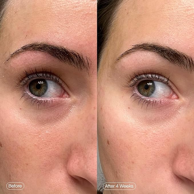 Topicals Faded Brightening Under Eye Masks | Patches to Depuff, Hydrate, Brighten and Cool | Reduce Dark Circles and Fine Lines | Contains Kojic Acid, Caffeine and Niacinamide (Set of 6)