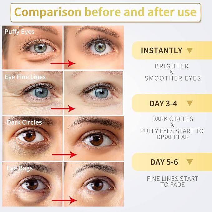 24K Gold Under Eye Patches - 60 Pack for Puffy Eyes, Dark Circles, Bags & Wrinkles with Collagen & Hyaluronic Acid - Eye Care Pads for Daily Skincare (Gold)