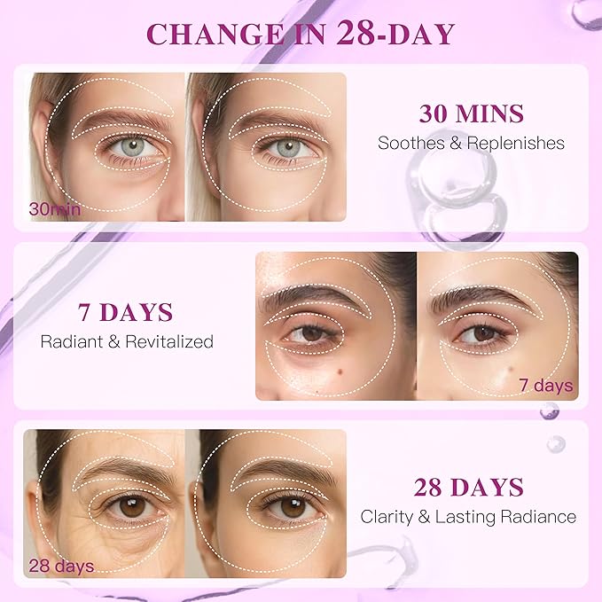 Under Eye Patches with Collagen, Eye Patches for Puffy Eyes and Dark Circles, 360° Under Eye Mask for Puffiness, Wrinkles, Fine Lines, Gifts for Women - Skin Care, 24 Pairs (White)