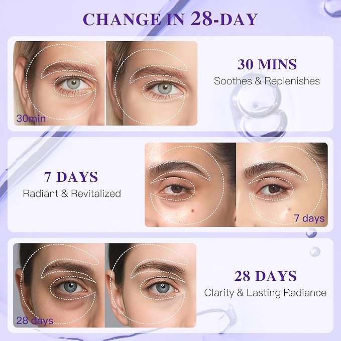 Under Eye Patches with Grape Seed Extract, Eye Patches for Puffy Eyes and Dark Circles, 360° Under Eye Mask for Radiance Boosting Effect, Dark‑Circle Reduction, Relieves Skin, 12 Pairs (Purple)