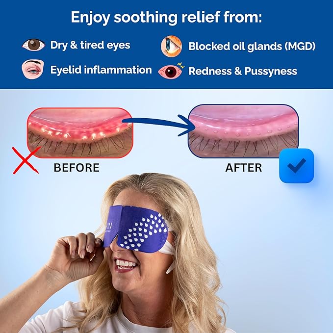 Rain Self Heating Steam Eye Mask for Dry Eyes - Warming Eye Compress with Moist Heat Therapy - Disposable Hot Compress Relief for Stye Treatment, Eye Fatigue & Dry Eye Relief (20 Masks)