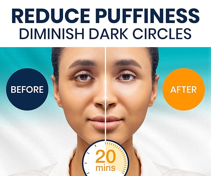 Stylia Collagen & Vitamin C Under Eye Patches for Puffy Eyes & Dark Circles - Depuffing, Hydrating & Firming Under Eye Mask with Hyaluronic Acid - Stocking Stuffers for Teen Girls, Vegan (6 Pairs)