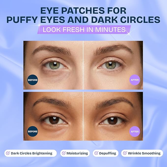 MAREE Under Eye Patches for Puffy Eyes and Dark Circles – Under Eye Mask with Collagen & Hyaluronic Acid – Undereye Mask Patches for Women – Parches para Ojeras Puffiness & Under Eye Bags | 12 Pair