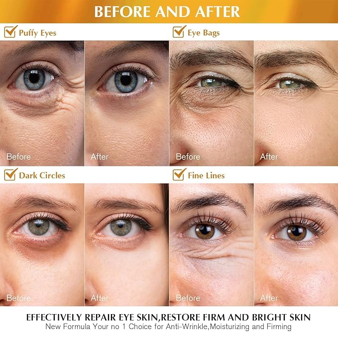 Enaskin Naturals Under Eye Patches for Dark Circles: 60 Pairs 24K Gold Eye Gels Mask - Reduce Wrinkles Puffy & Bags - Skin Treatment Pads - Anti Aging Moisturizer For Women (Gold 2 Pack)