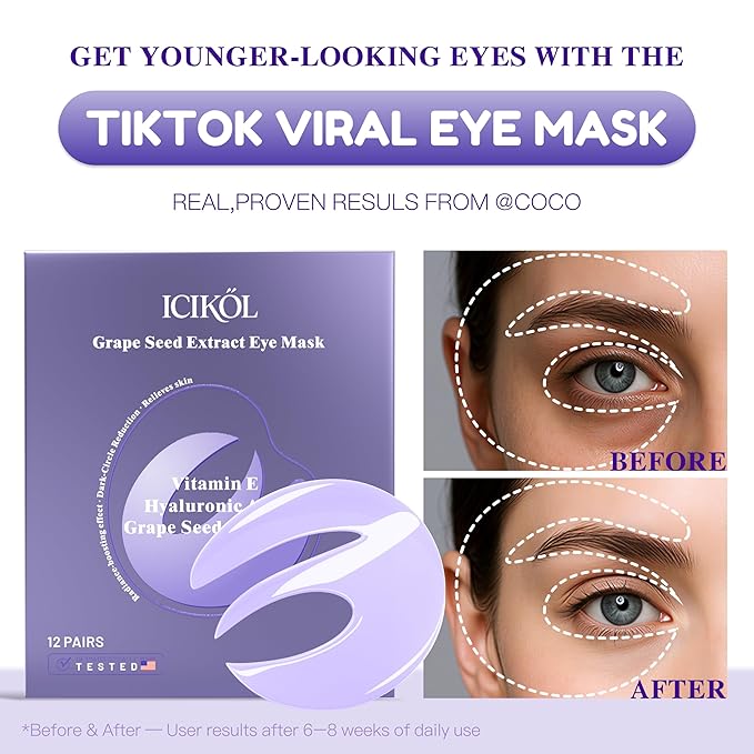 Under Eye Patches with Grape Seed Extract, Eye Patches for Puffy Eyes and Dark Circles, 360° Under Eye Mask for Radiance Boosting Effect, Dark‑Circle Reduction, Relieves Skin, 12 Pairs (Purple)