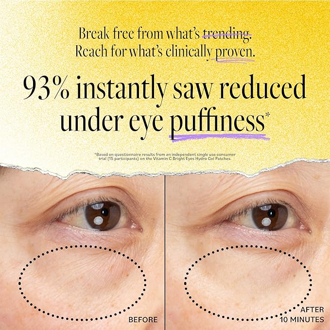 Derma E Vitamin C Bright Eyes Hydro Gel Under Eye Patches for Dark Circles (10 Ct, 5 Pairs) Allantoin, Caffeine & Vitamin B3, Eye Patches for Fine Lines, Wrinkles, Dark Circles & Puffy Eyes